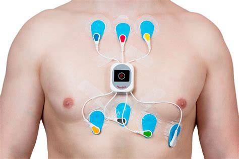 Esami cardiologici ECG ecocardiogramma Holter