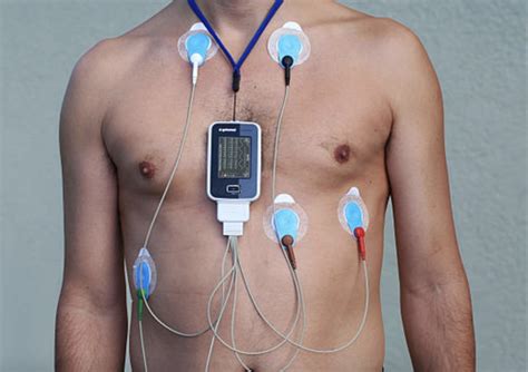 Elettrocardiogramma e monitoraggio Holter