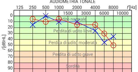 otorinolaringoiatria esame audiometrico diagramma